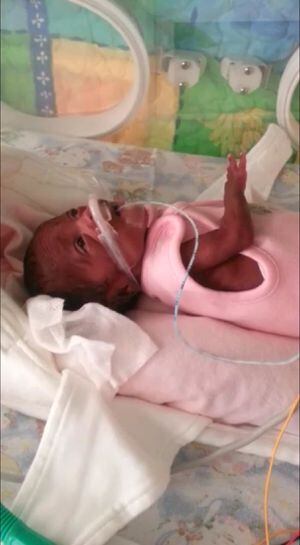 'Emotional' survival story of Wolverhampton girl born looking like 'a ...