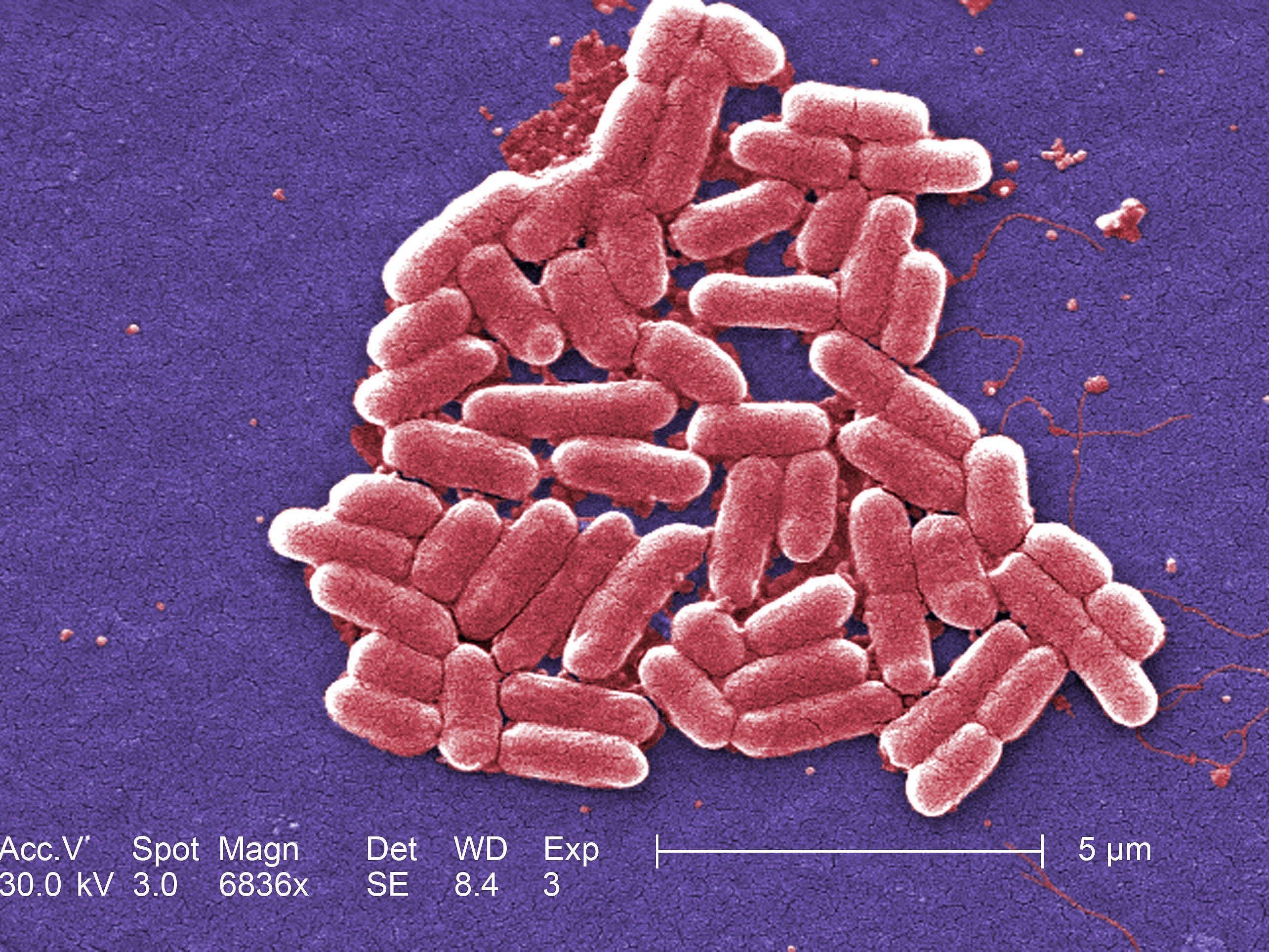E. coli outbreak: 86 people taken to hospital but cases are slowing down