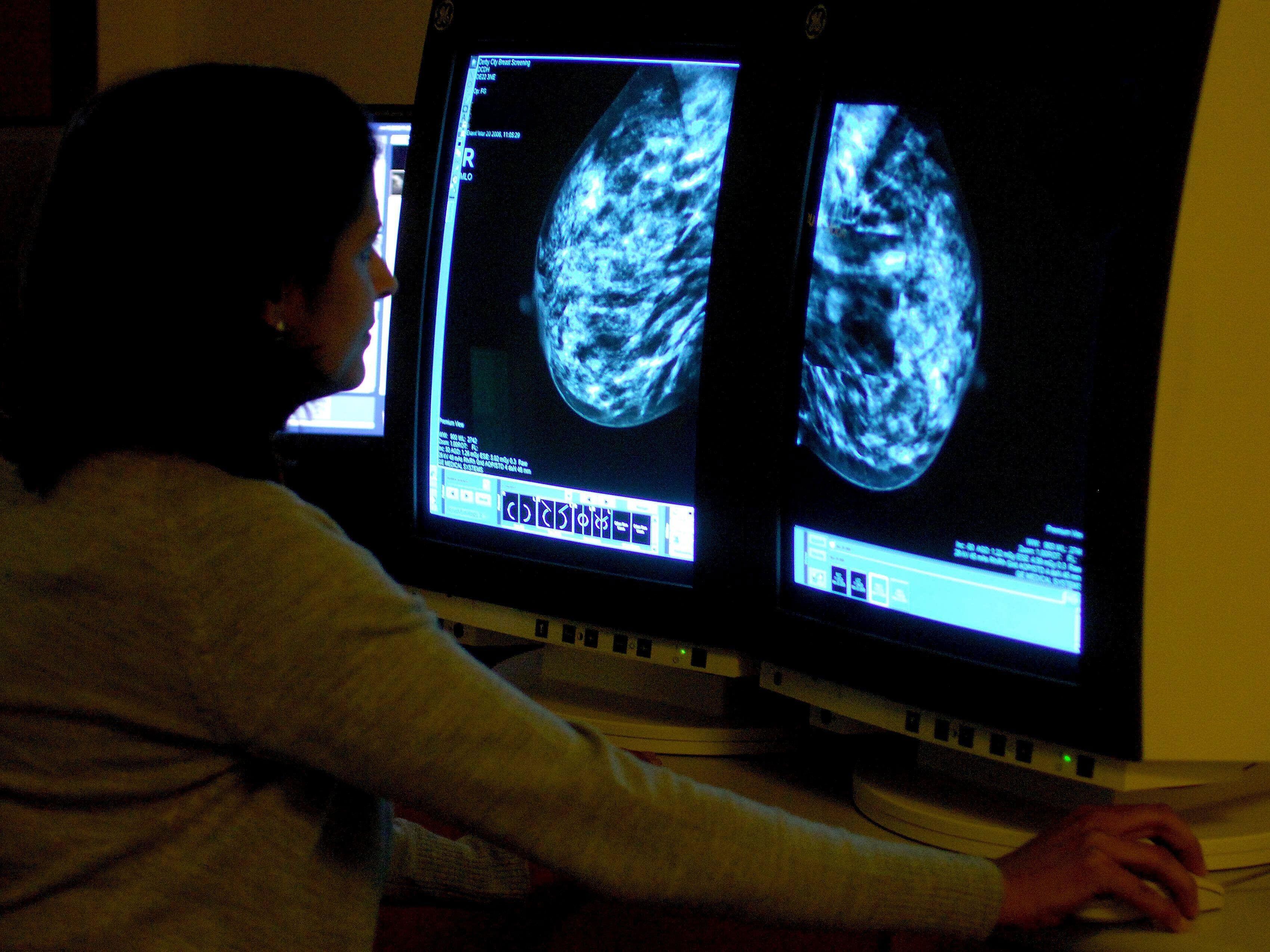 82,000 Midlands women not up to date with live-saving breast cancer checks 