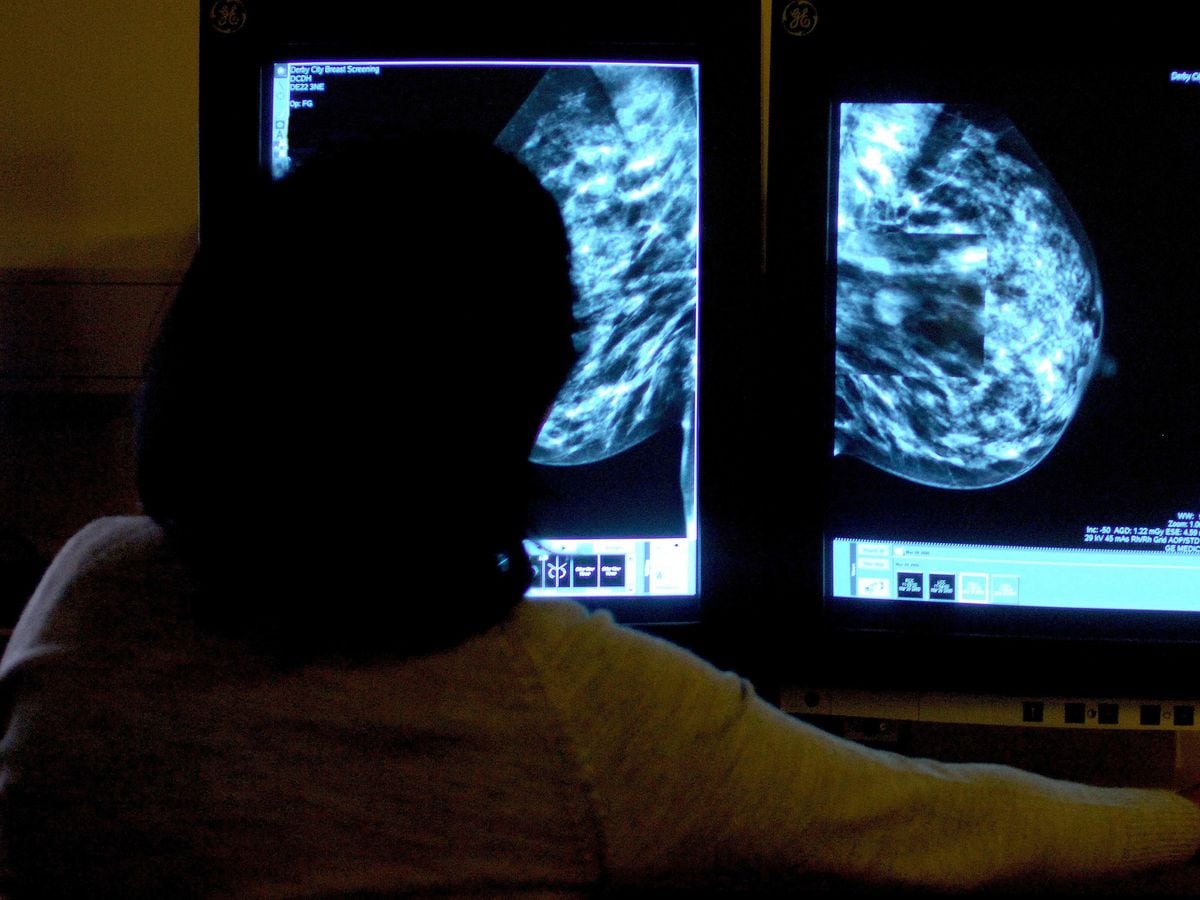 New Breast Cancer Drugs To Benefit Thousands | Express & Star