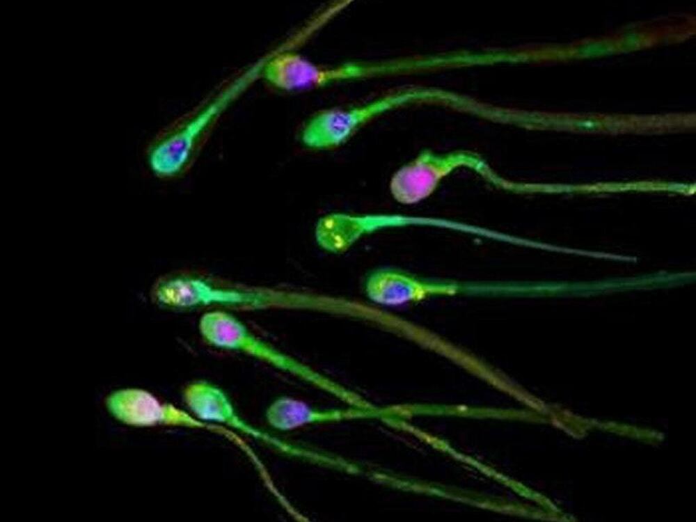 gelatin lumps in sperm