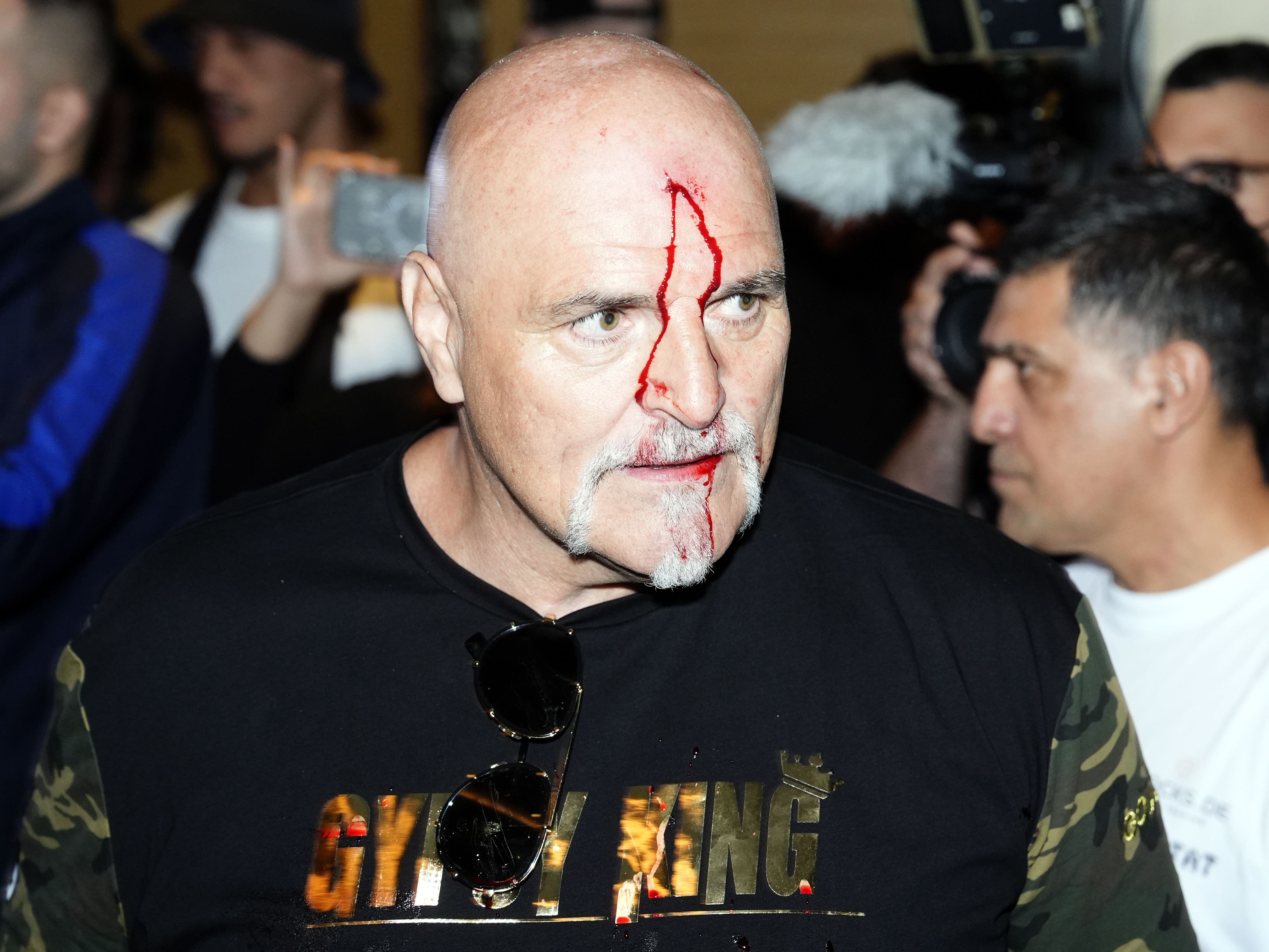 Tyson Fury’s father John suffers cut to head as Oleksandr Usyk fight week begins
