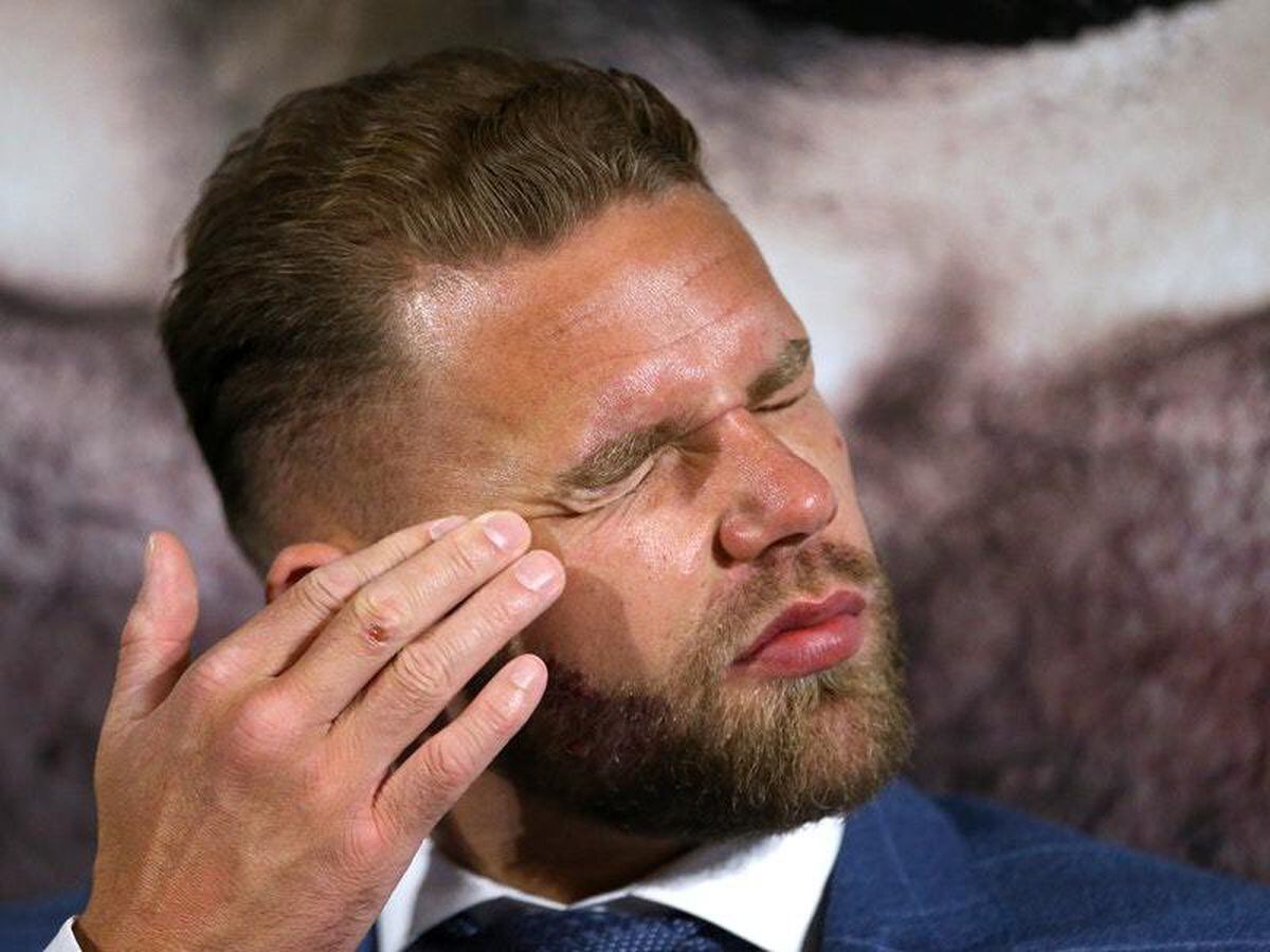 Billy Joe Saunders charged with misconduct over 'sickening ...