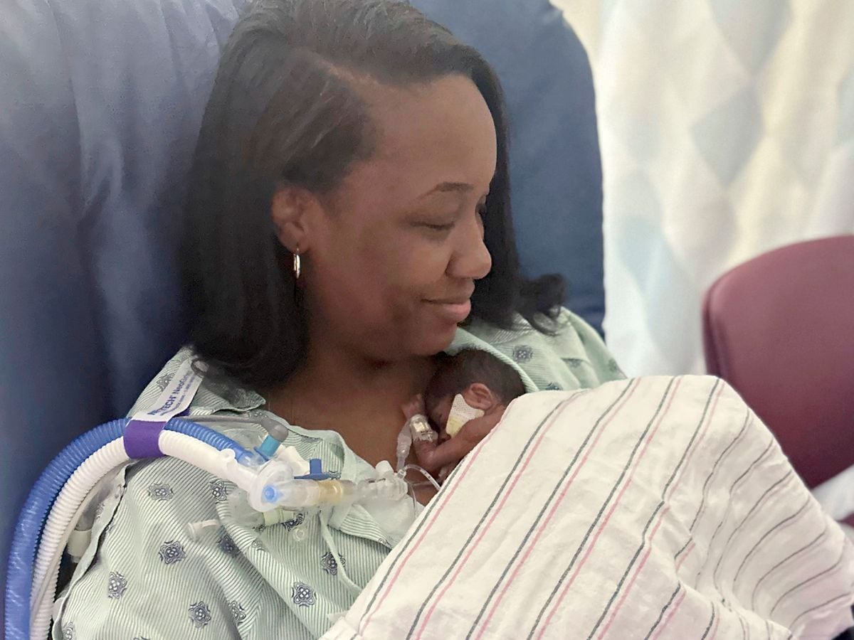 ‘Micropreemie’ baby who weighed 1lb and 1oz at birth goes home from ...