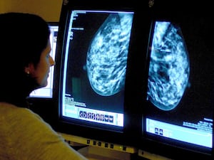 A consultant analysing a mammogram on a screen