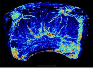 A super-resolution prostate image