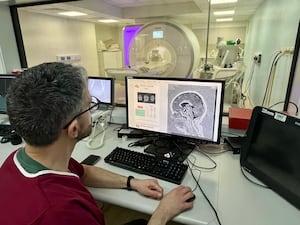 Dr Felice D'Arco, consultant radiologist at Great Ormond Street Hospital, reviewing the scan and AI report of a person with complex epilepsy