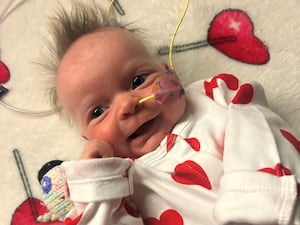 Baby Dolcie-Mae Edwards-Raymond in hospital with a wire attached to her face