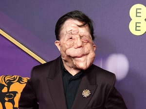 Adam Pearson against the purple Bafta backdrop