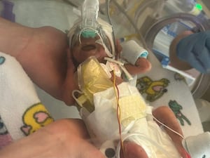 Hope as a newborn, with tubes attached inside an incubator