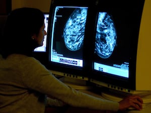 A medical professional looking at a mammogram on two screens