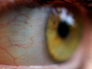 A close-up photo of an eye