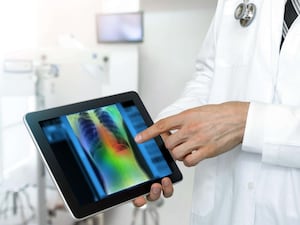 Doctor using AI algorithm and machine learning to detect pneumonia